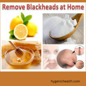 removal from blackheads