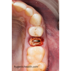 tooth problem and solution